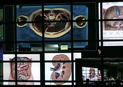 Anatomy Class Visuals on EVL’s Tiled Display