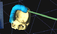 The defect tool traces a path for extracting the defect geometry