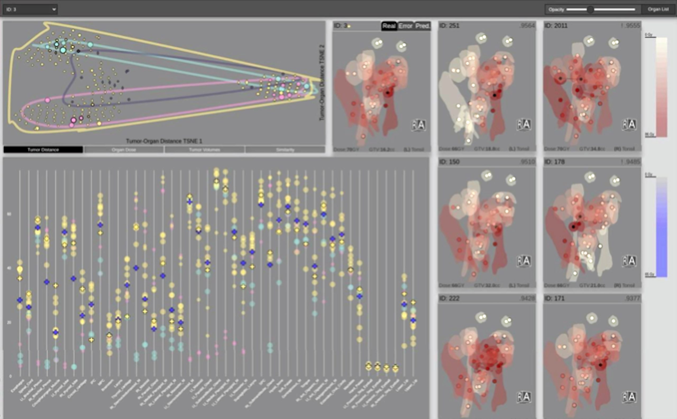 Cohort-based radiation therapy prediction using T-SSIM, where a stylized 3D view of the predicted radiation plan of the current patient is used. Additional RT views show the most similar patients who contribute to the prediction.
